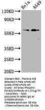 Phospho-SMAD2 (S250) Recombinant Monoclonal Antibody