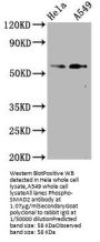 Phospho-SMAD2 (S250) Recombinant Monoclonal Antibody