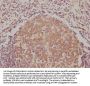 BAK1 Recombinant Monoclonal Antibody