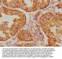 BAK1 Recombinant Monoclonal Antibody