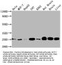 SOD2 Recombinant Monoclonal Antibody