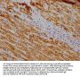 SOD2 Recombinant Monoclonal Antibody