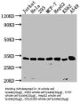 CDK4 Recombinant Monoclonal Antibody