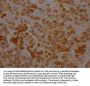 SERPINH1 Recombinant Monoclonal Antibody