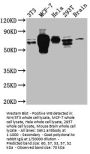 RPS6KB1 Recombinant Monoclonal Antibody