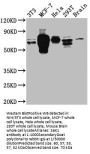 RPS6KB1 Recombinant Monoclonal Antibody