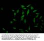MAPK14 Recombinant Monoclonal Antibody