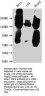 EGFR Recombinant Monoclonal Antibody