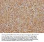 EGFR Recombinant Monoclonal Antibody