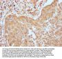 EGFR Recombinant Monoclonal Antibody