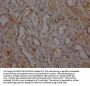 LRRK2 Recombinant Monoclonal Antibody
