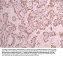 PBRM1 Recombinant Monoclonal Antibody