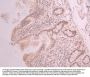 PBRM1 Recombinant Monoclonal Antibody