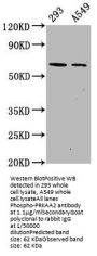 Phospho-PRKAA2 (S491) Recombinant Monoclonal Antibody