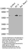 E2F1 Recombinant Monoclonal Antibody