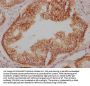 SNAP23 Recombinant Monoclonal Antibody