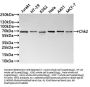 CHEK2 Recombinant Monoclonal Antibody