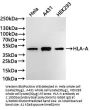 HLA-B&HLA-A Recombinant Monoclonal Antibody