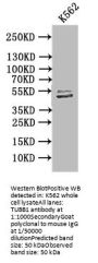 TUBB1 Recombinant Monoclonal Antibody