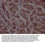 CUL3 Recombinant Monoclonal Antibody