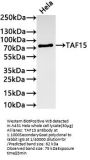 TAF15 Recombinant Monoclonal Antibody