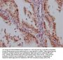 HDAC3 Recombinant Monoclonal Antibody