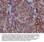 HDAC3 Recombinant Monoclonal Antibody