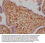 LOXL2 Recombinant Monoclonal Antibody