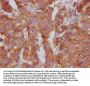 CD46 Recombinant Monoclonal Antibody