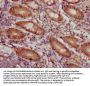 CD46 Recombinant Monoclonal Antibody