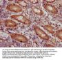 CD46 Recombinant Monoclonal Antibody