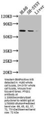 PTGS1 Recombinant Monoclonal Antibody