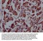 FGFR4 Recombinant Monoclonal Antibody