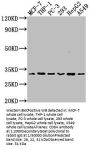 CD8A Recombinant Monoclonal Antibody