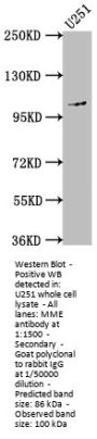 MME Recombinant Monoclonal Antibody