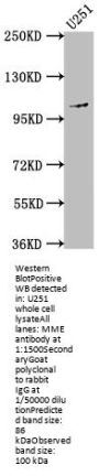 MME Recombinant Monoclonal Antibody