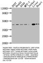 AGTR2 Recombinant Monoclonal Antibody