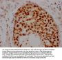 HDAC2 Recombinant Monoclonal Antibody