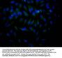 HDAC2 Recombinant Monoclonal Antibody