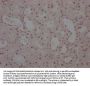 WT1 Recombinant Monoclonal Antibody