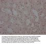 WT1 Recombinant Monoclonal Antibody