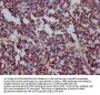 HSPD1 Recombinant Monoclonal Antibody