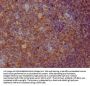 CD22 Recombinant Monoclonal Antibody
