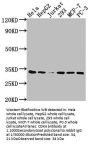 CDK4 Recombinant Monoclonal Antibody
