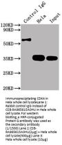 CDK4 Recombinant Monoclonal Antibody