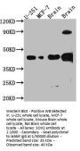 SOX2 Recombinant Monoclonal Antibody