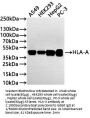 HLA-A Recombinant Monoclonal Antibody
