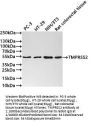 TMPRSS2 Recombinant Monoclonal Antibody