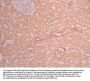 TMPRSS2 Recombinant Monoclonal Antibody