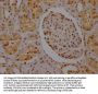 SYNCRIP Recombinant Monoclonal Antibody